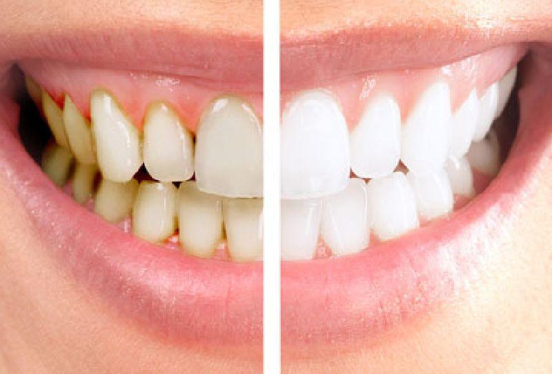 DENTI1-2-1.jpeg